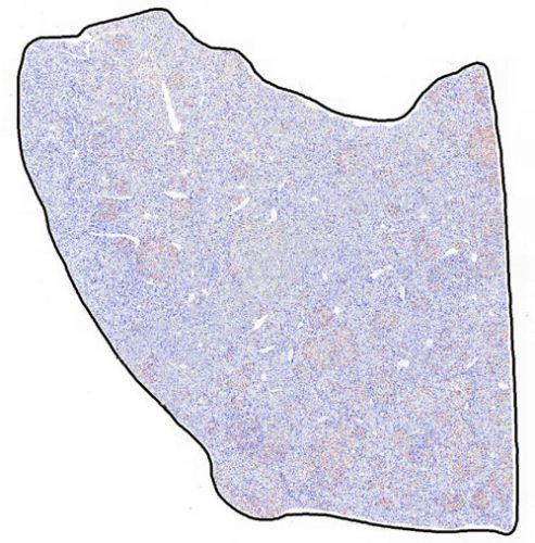 IHC切片AI分析(個(gè)數(shù))
