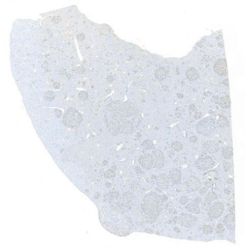 IHC切片AI分析(個(gè)數(shù))