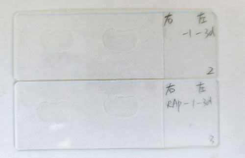 冰凍切片